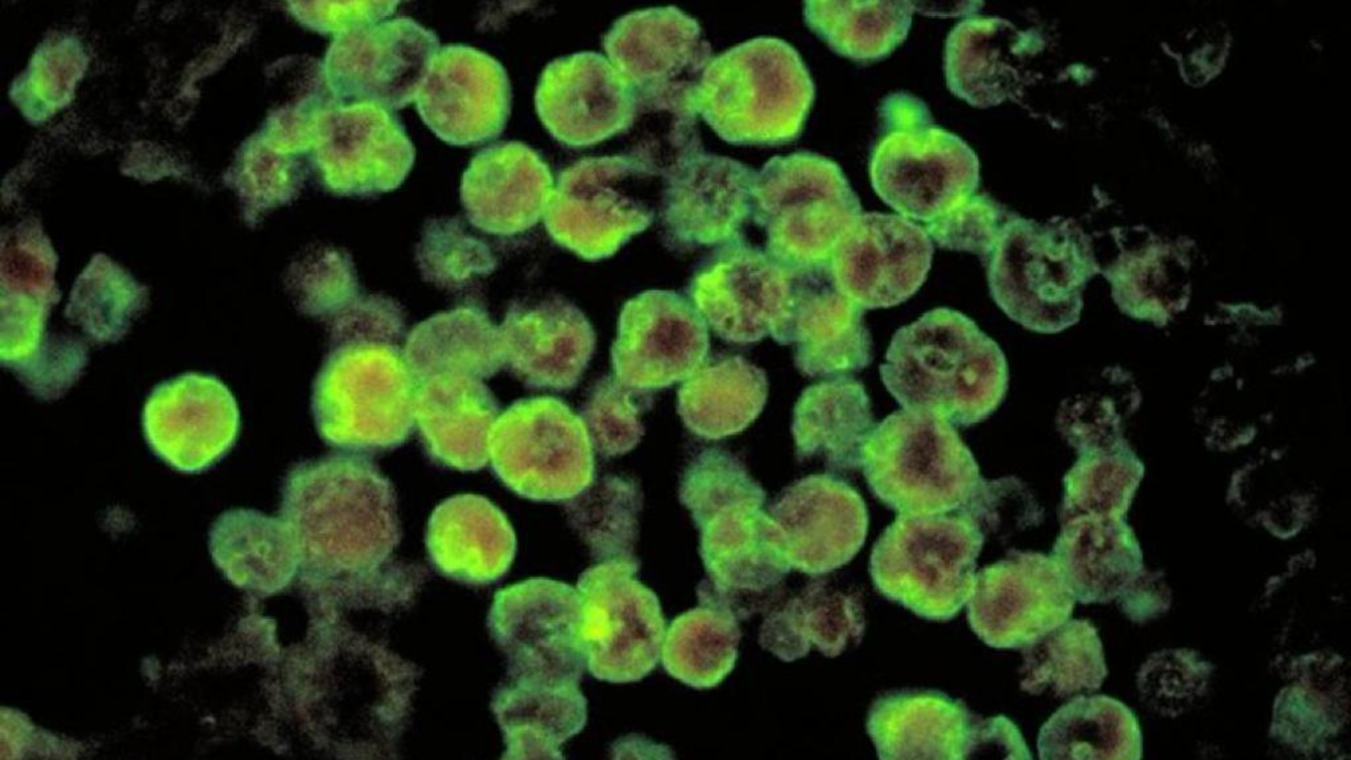 Ameba mangia cervello: il rischio per chi fa lavaggi nasali